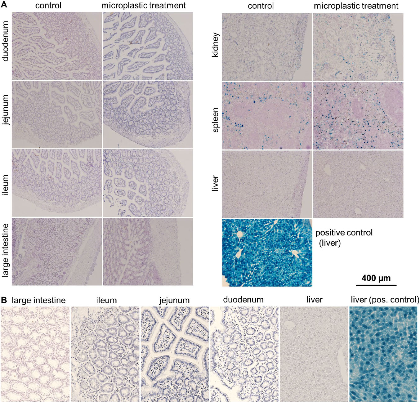 Uptake and effects of orally ingested EPS expanded polystyrene airpop microplastic particles in vitro and in vivo